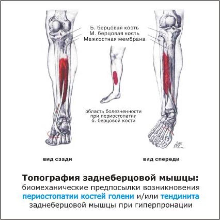 Болит нога кость большая. Почему болят ноги в кости голени спереди. Болит нога сбоку от голени. Болит кость голени сбоку.